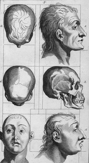 Los 316 - Pinel, Philippe - Philosophisch-medicinische Abhandlung über Geistesverirrungen oder Manie - 1 - thumb